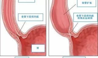 饭坑酒囊的意思是什么,出处是哪里